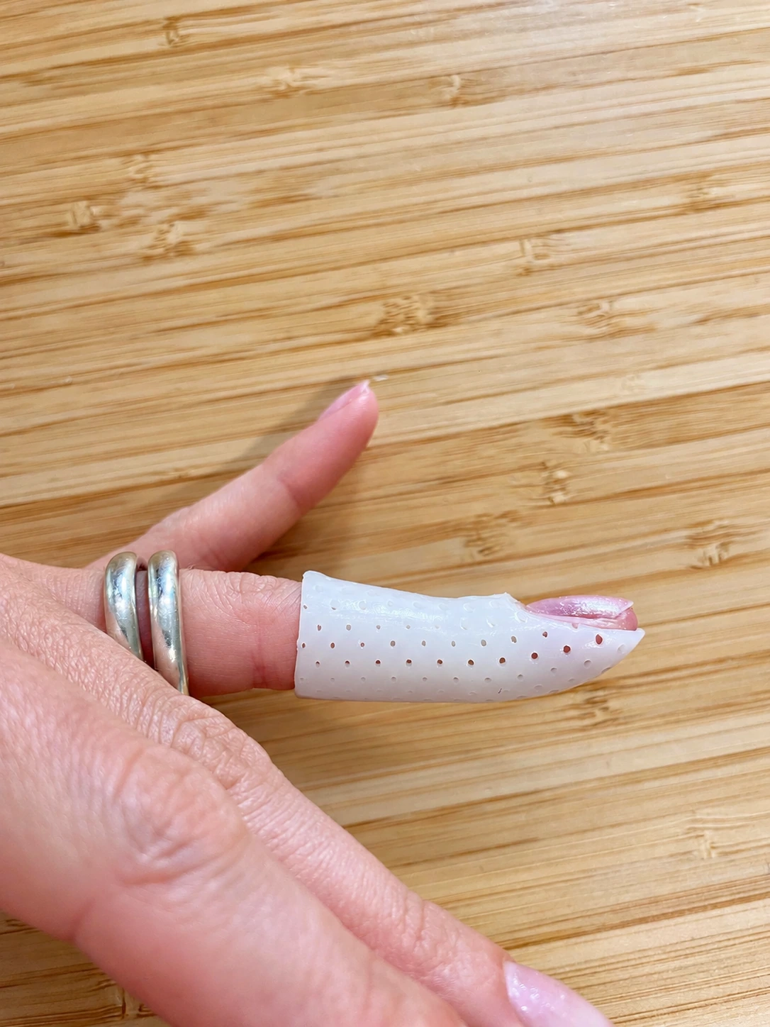 Orthèse de doigt sur mesure pour mallet finger, portée sur l’extrémité du doigt